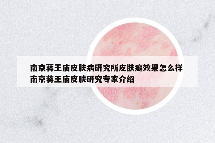 南京蔣王廟皮膚病研究所皮膚癬效果怎么樣 南京蔣王廟皮膚研究專家介紹