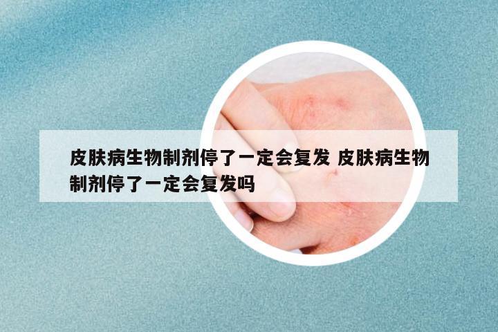 皮膚病生物制劑停了一定會(huì)復(fù)發(fā) 皮膚病生物制劑停了一定會(huì)復(fù)發(fā)嗎
