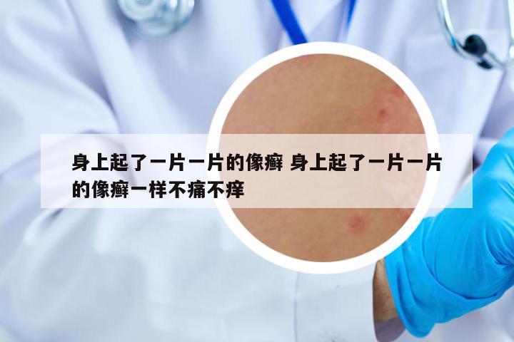 身上起了一片一片的像癬 身上起了一片一片的像癬一樣不痛不癢