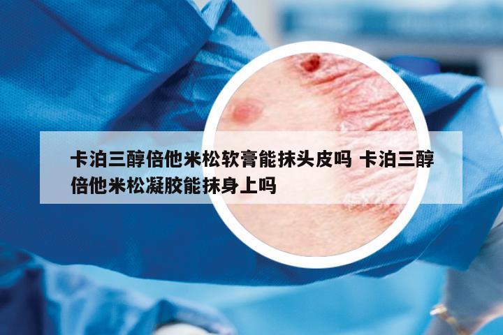 卡泊三醇倍他米松軟膏能抹頭皮嗎 卡泊三醇倍他米松凝膠能抹身上嗎