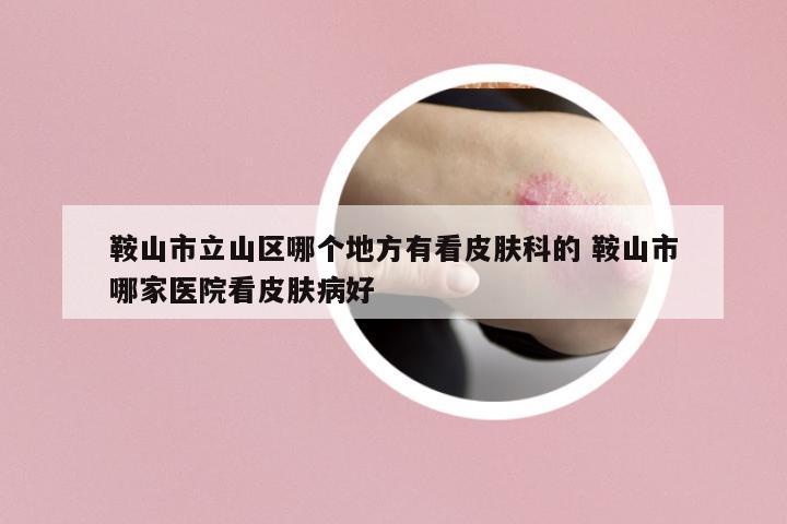 鞍山市立山區(qū)哪個地方有看皮膚科的 鞍山市哪家醫(yī)院看皮膚病好