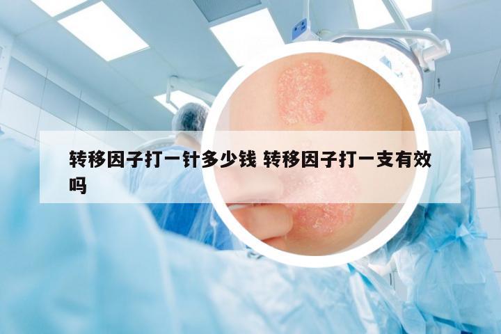 轉移因子打一針多少錢 轉移因子打一支有效嗎