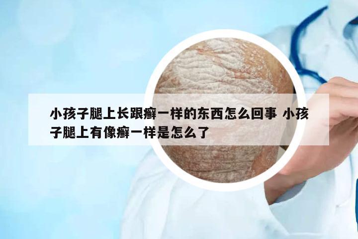 小孩子腿上長跟癬一樣的東西怎么回事 小孩子腿上有像癬一樣是怎么了