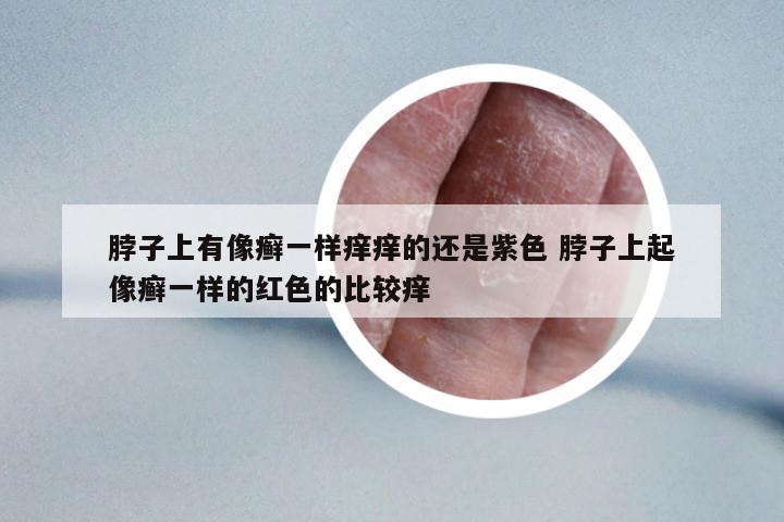 脖子上有像癬一樣癢癢的還是紫色 脖子上起像癬一樣的紅色的比較癢