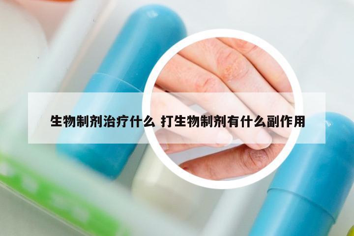 生物制劑治療什么 打生物制劑有什么副作用