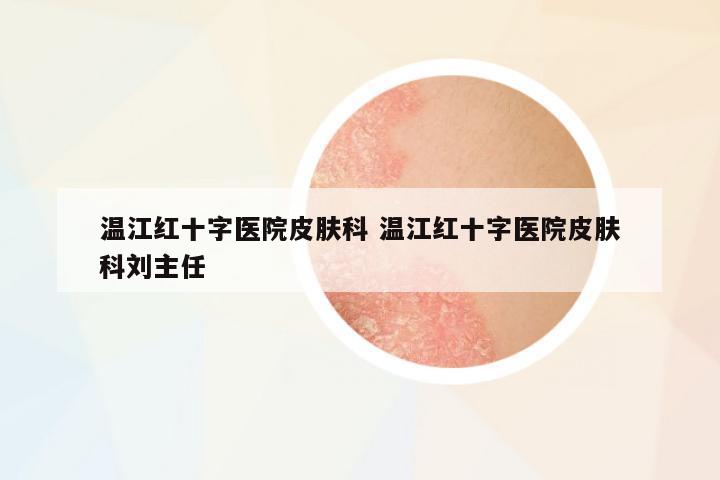 溫江紅十字醫(yī)院皮膚科 溫江紅十字醫(yī)院皮膚科劉主任