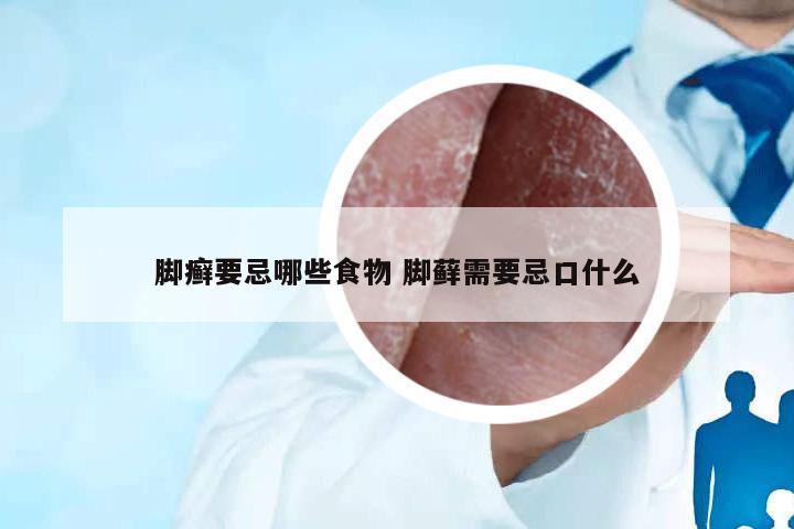 腳癬要忌哪些食物 腳蘚需要忌口什么