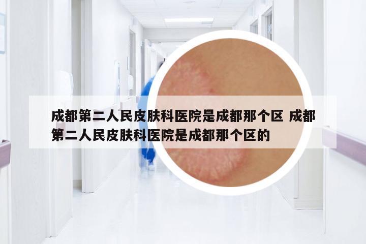 成都第二人民皮膚科醫(yī)院是成都那個區(qū) 成都第二人民皮膚科醫(yī)院是成都那個區(qū)的