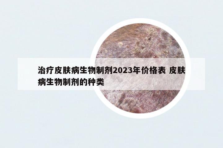 治療皮膚病生物制劑2023年價(jià)格表 皮膚病生物制劑的種類