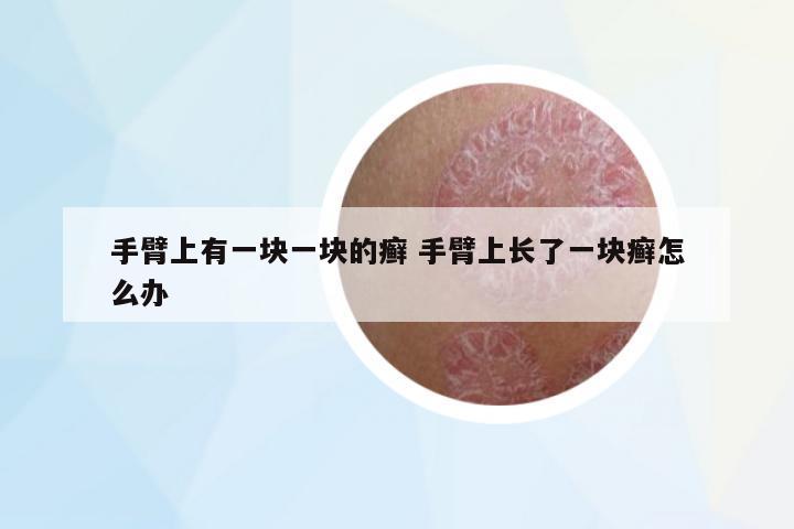 手臂上有一塊一塊的癬 手臂上長(zhǎng)了一塊癬怎么辦