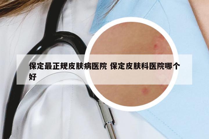 保定最正規(guī)皮膚病醫(yī)院 保定皮膚科醫(yī)院哪個好