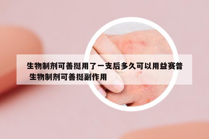 生物制劑可善挺用了一支后多久可以用益賽普 生物制劑可善挺副作用