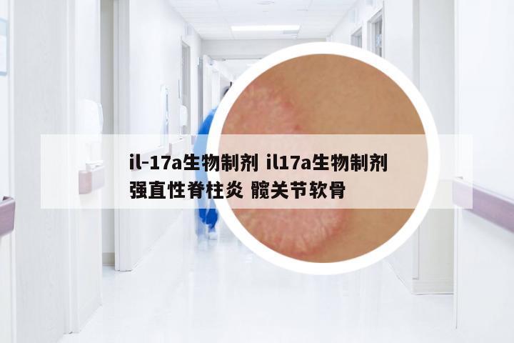 il-17a生物制劑 il17a生物制劑強直性脊柱炎 髖關(guān)節(jié)軟骨