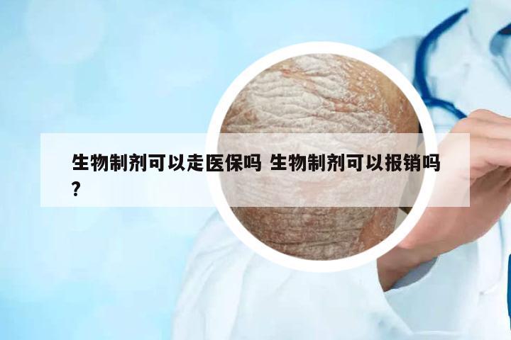 生物制劑可以走醫(yī)保嗎 生物制劑可以報銷嗎?
