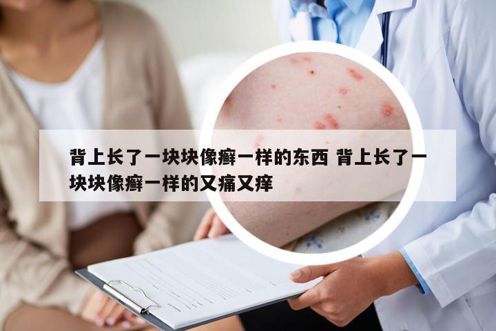 背上長(zhǎng)了一塊塊像癬一樣的東西 背上長(zhǎng)了一塊塊像癬一樣的又痛又癢