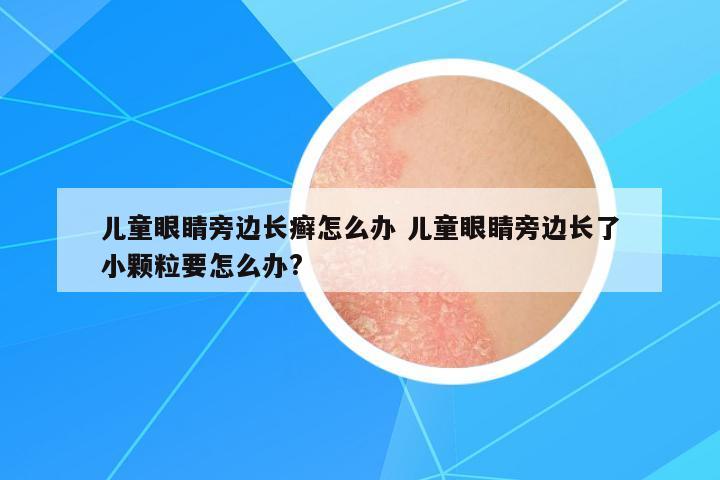 兒童眼睛旁邊長癬怎么辦 兒童眼睛旁邊長了小顆粒要怎么辦?