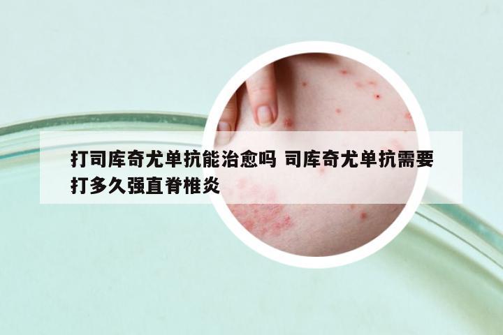 打司庫(kù)奇尤單抗能治愈嗎 司庫(kù)奇尤單抗需要打多久強(qiáng)直脊椎炎