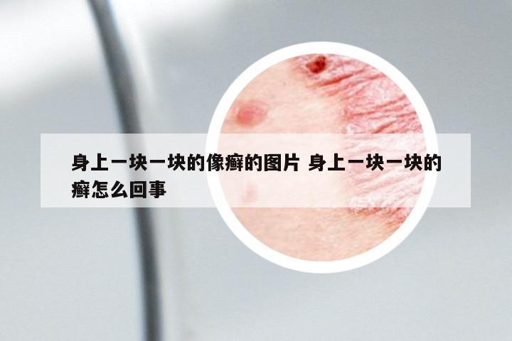 身上一塊一塊的像癬的圖片 身上一塊一塊的癬怎么回事