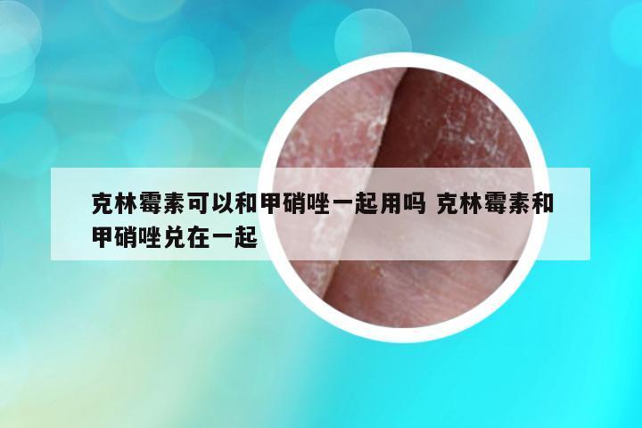 克林霉素可以和甲硝唑一起用嗎 克林霉素和甲硝唑兌在一起