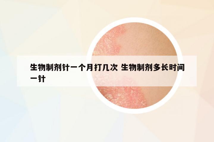 生物制劑針一個月打幾次 生物制劑多長時間一針