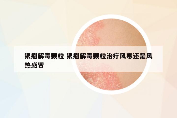 銀翹解毒顆粒 銀翹解毒顆粒治療風(fēng)寒還是風(fēng)熱感冒