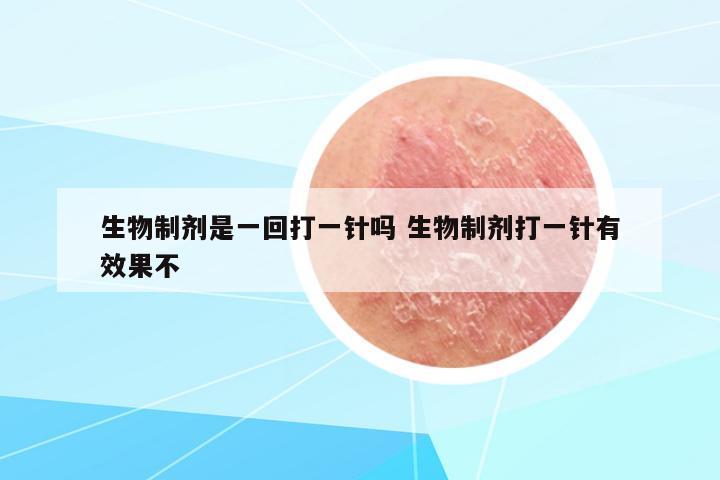 生物制劑是一回打一針嗎 生物制劑打一針有效果不