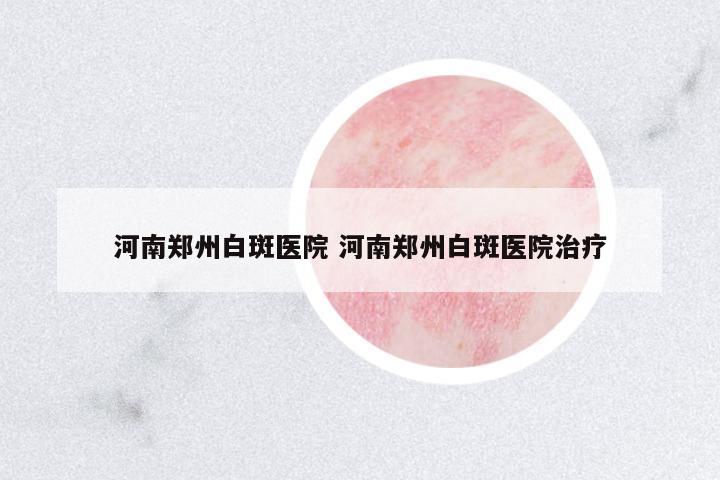 河南鄭州白斑醫(yī)院 河南鄭州白斑醫(yī)院治療