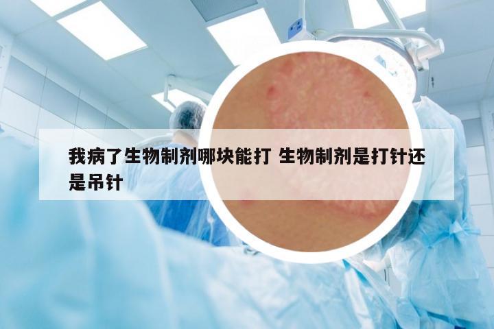 我病了生物制劑哪塊能打 生物制劑是打針還是吊針