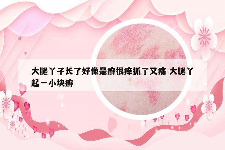 大腿丫子長(zhǎng)了好像是癬很癢抓了又痛 大腿丫起一小塊癬