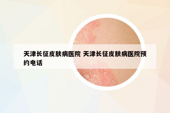 天津長征皮膚病醫(yī)院 天津長征皮膚病醫(yī)院預(yù)約電話