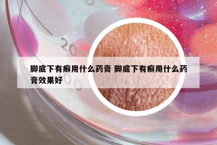 腳底下有癬用什么藥膏 腳底下有癬用什么藥膏效果好