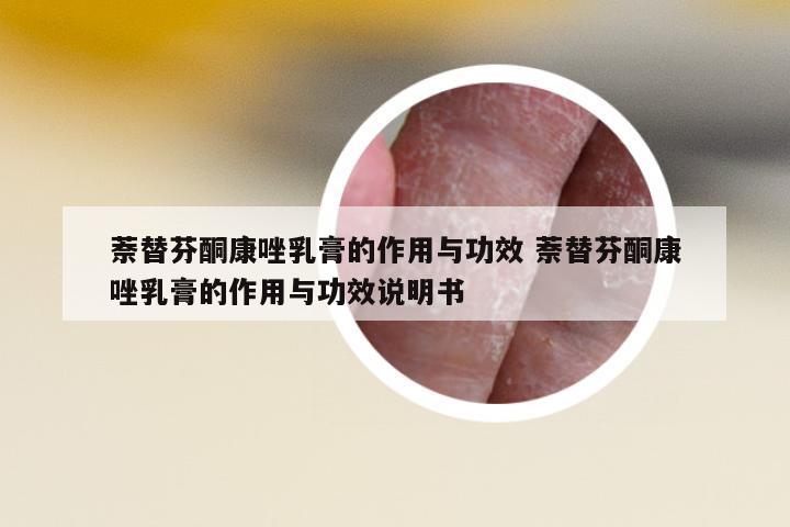 萘替芬酮康唑乳膏的作用與功效 萘替芬酮康唑乳膏的作用與功效說(shuō)明書(shū)