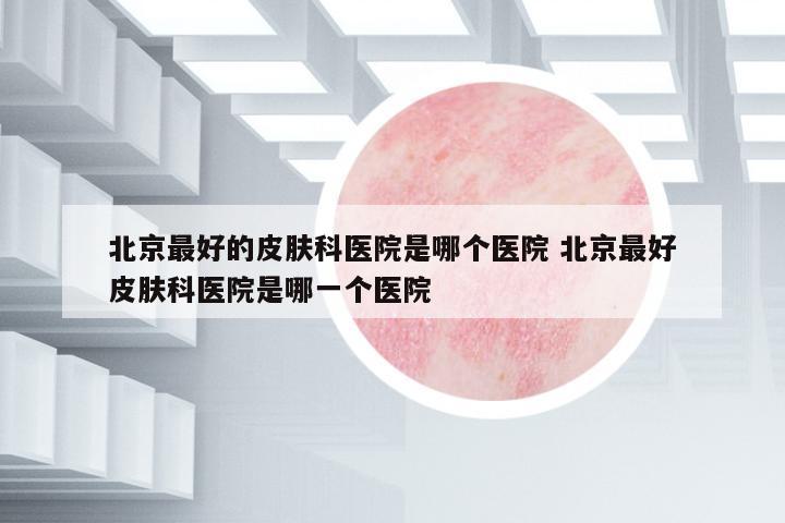 北京最好的皮膚科醫(yī)院是哪個醫(yī)院 北京最好皮膚科醫(yī)院是哪一個醫(yī)院