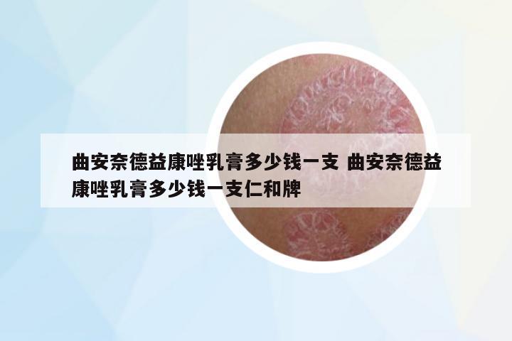 曲安奈德益康唑乳膏多少錢一支 曲安奈德益康唑乳膏多少錢一支仁和牌