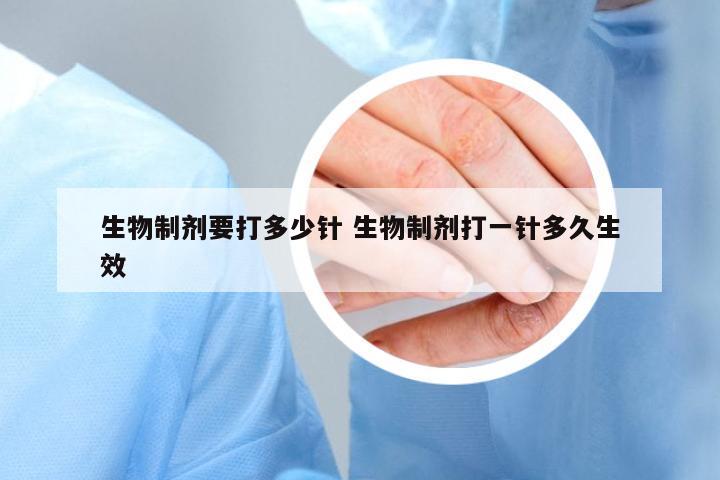 生物制劑要打多少針 生物制劑打一針多久生效