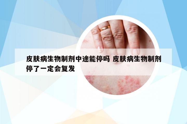 皮膚病生物制劑中途能停嗎 皮膚病生物制劑停了一定會(huì)復(fù)發(fā)