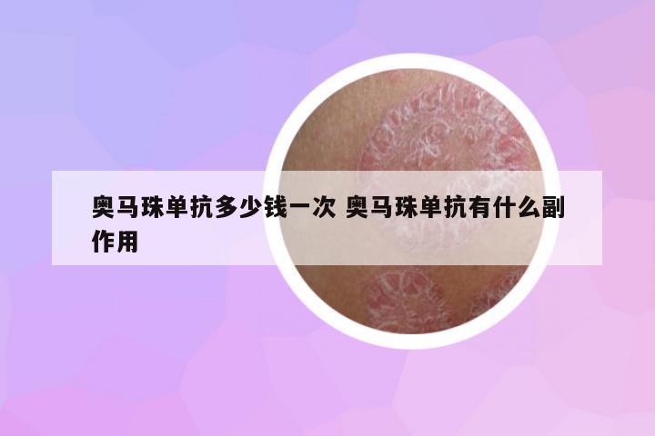 奧馬珠單抗多少錢一次 奧馬珠單抗有什么副作用