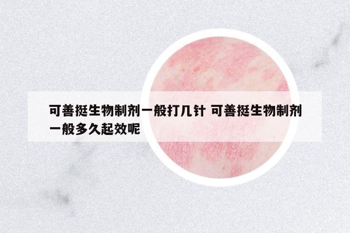 可善挺生物制劑一般打幾針 可善挺生物制劑一般多久起效呢