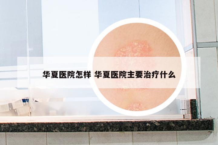 華夏醫(yī)院怎樣 華夏醫(yī)院主要治療什么