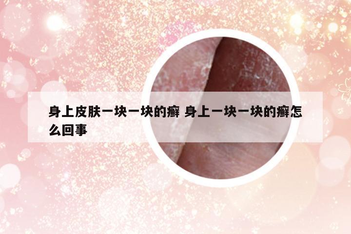 身上皮膚一塊一塊的癬 身上一塊一塊的癬怎么回事