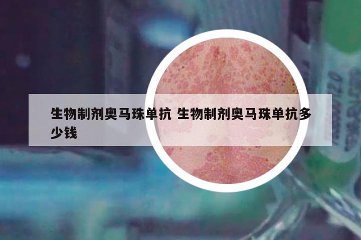 生物制劑奧馬珠單抗 生物制劑奧馬珠單抗多少錢(qián)