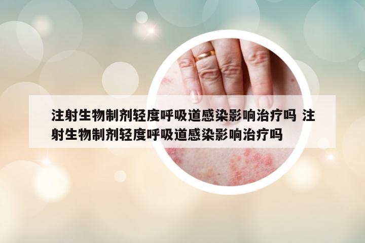 注射生物制劑輕度呼吸道感染影響治療嗎 注射生物制劑輕度呼吸道感染影響治療嗎