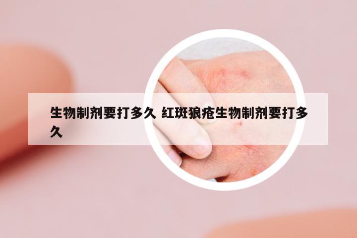 生物制劑要打多久 紅斑狼瘡生物制劑要打多久