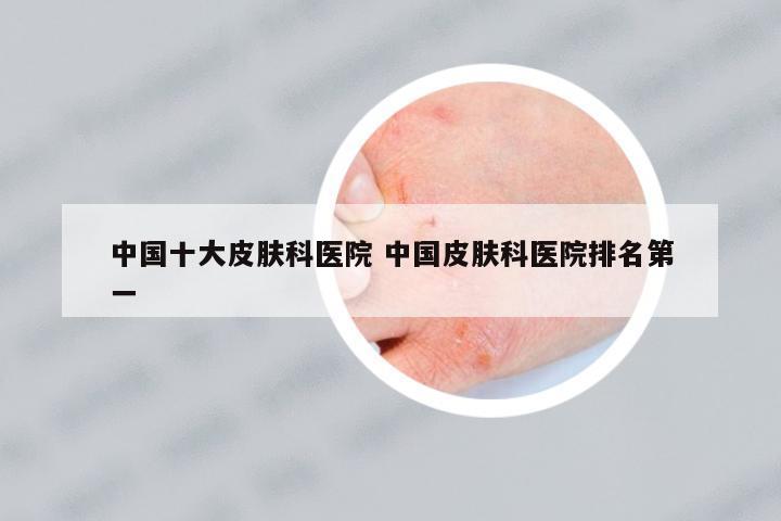 中國(guó)十大皮膚科醫(yī)院 中國(guó)皮膚科醫(yī)院排名第一
