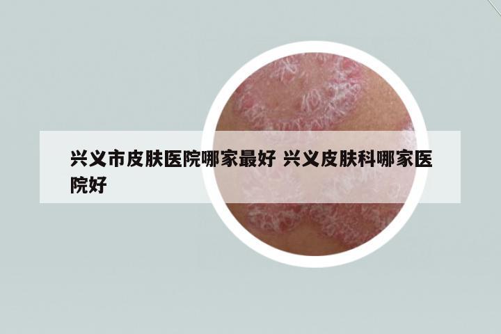 興義市皮膚醫(yī)院哪家最好 興義皮膚科哪家醫(yī)院好