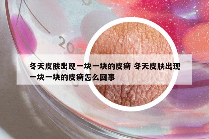 冬天皮膚出現(xiàn)一塊一塊的皮癬 冬天皮膚出現(xiàn)一塊一塊的皮癬怎么回事