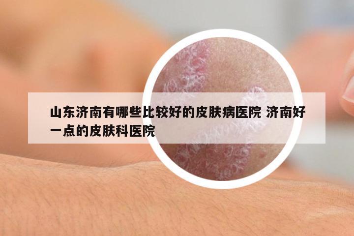山東濟南有哪些比較好的皮膚病醫(yī)院 濟南好一點的皮膚科醫(yī)院