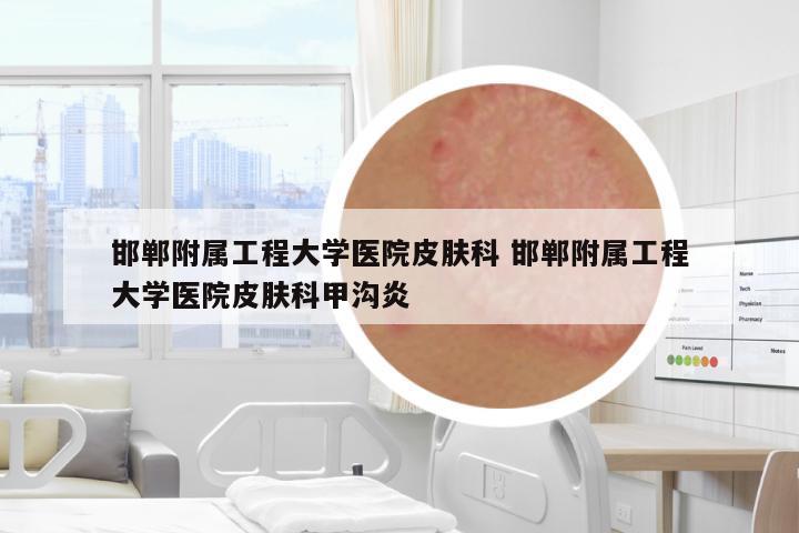 邯鄲附屬工程大學醫(yī)院皮膚科 邯鄲附屬工程大學醫(yī)院皮膚科甲溝炎