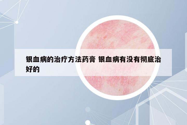 銀血病的治療方法藥膏 銀血病有沒有徹底治好的