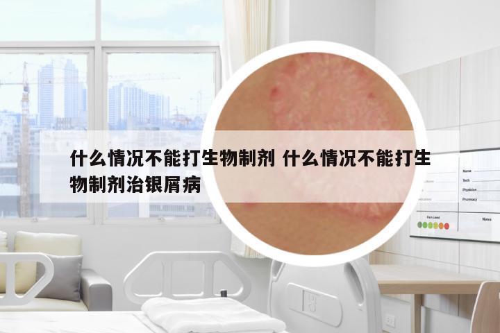 什么情況不能打生物制劑 什么情況不能打生物制劑治銀屑病